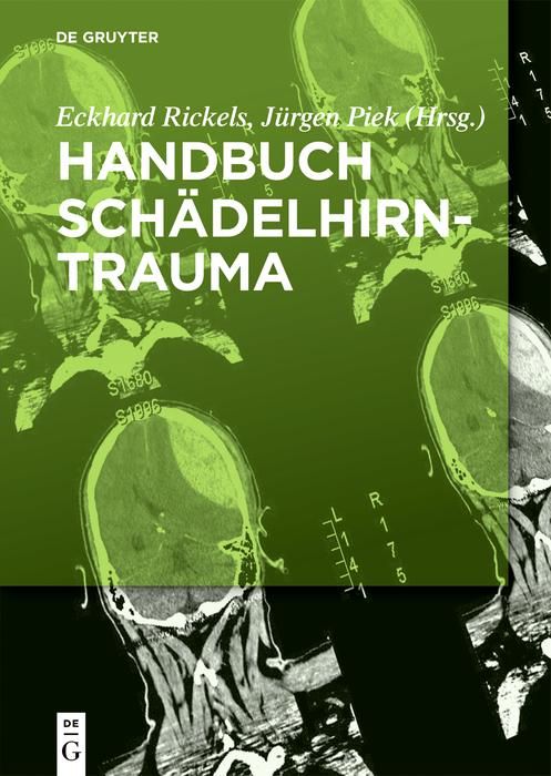Produktbild: Handbuch Sch&auml;delhirntrauma