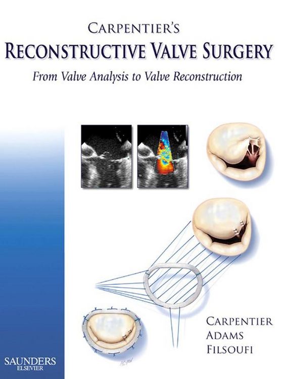 Produktbild: Carpentier's Reconstructive Valve Surgery