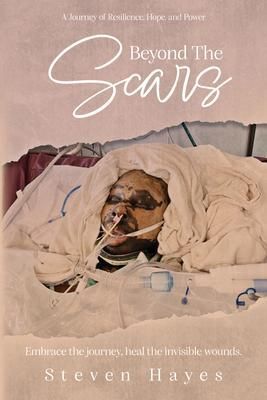 Produktbild: Beyond The Scars