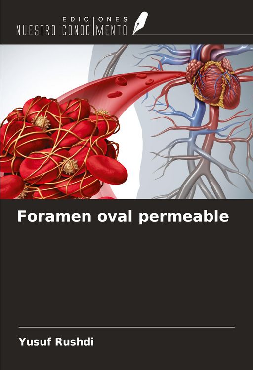 Produktbild: Foramen oval permeable
