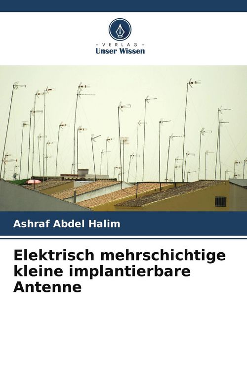 Produktbild: Elektrisch mehrschichtige kleine implantierbare Antenne