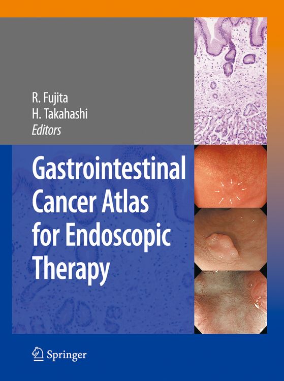 Produktbild: Gastrointestinal Cancer Atlas for Endoscopic Therapy