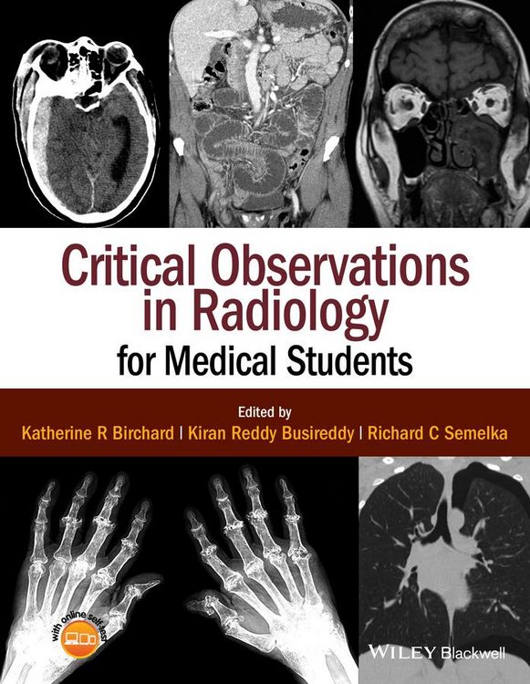 Produktbild: Critical Observations in Radiology for Medical Students