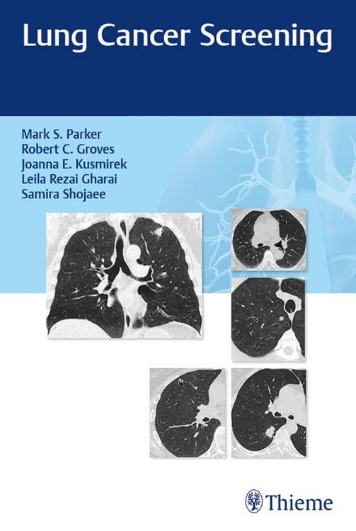 Produktbild: Lung Cancer Screening