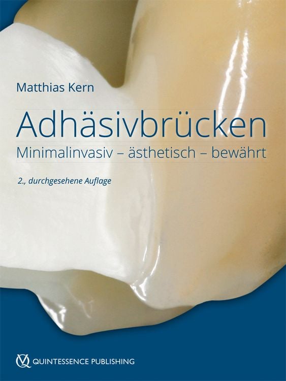 Produktbild: Adh&auml;sivbr&uuml;cken
