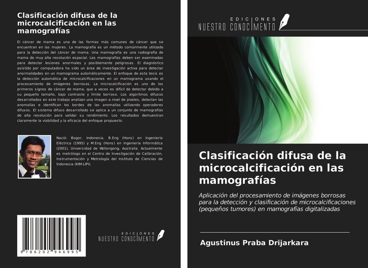 Produktbild: Clasificaci&oacute;n difusa de la microcalcificaci&oacute;n en las mamograf&iacute;as
