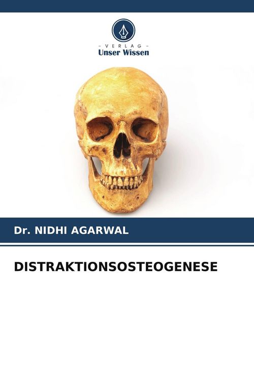 Produktbild: Distraktionsosteogenese