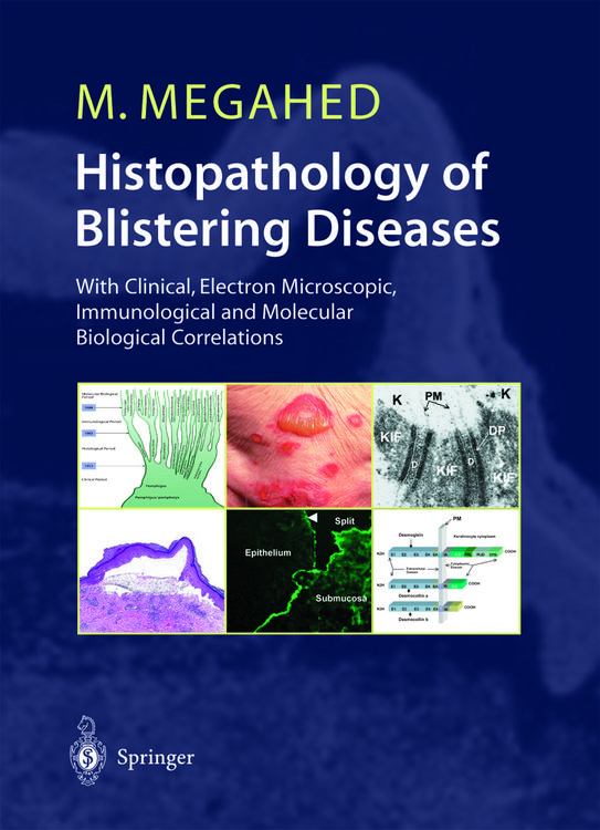 Produktbild: Histopathology of Blistering Diseases