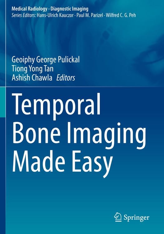 Produktbild: Temporal Bone Imaging Made Easy