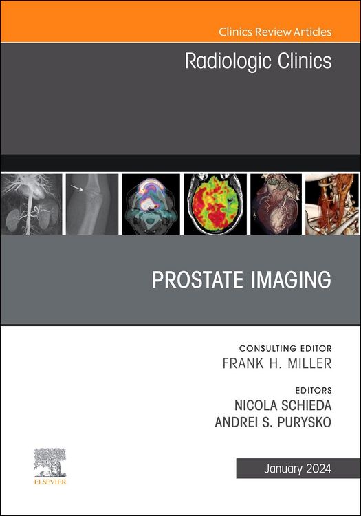 Produktbild: Prostate Imaging, an Issue of Radiologic Clinics of North America