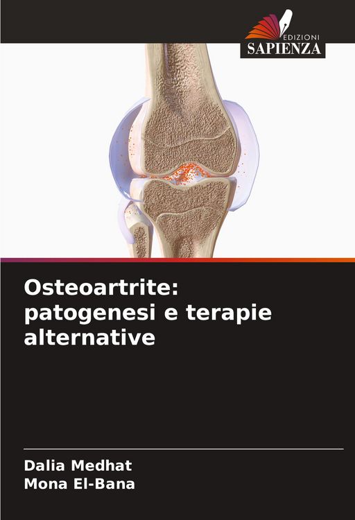 Produktbild: Osteoartrite: patogenesi e terapie alternative