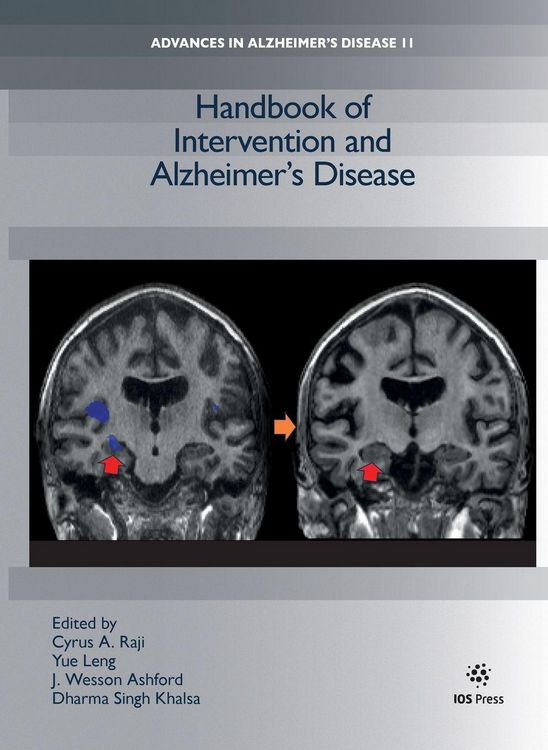 Produktbild: Handbook of Intervention and Alzheimer's Disease