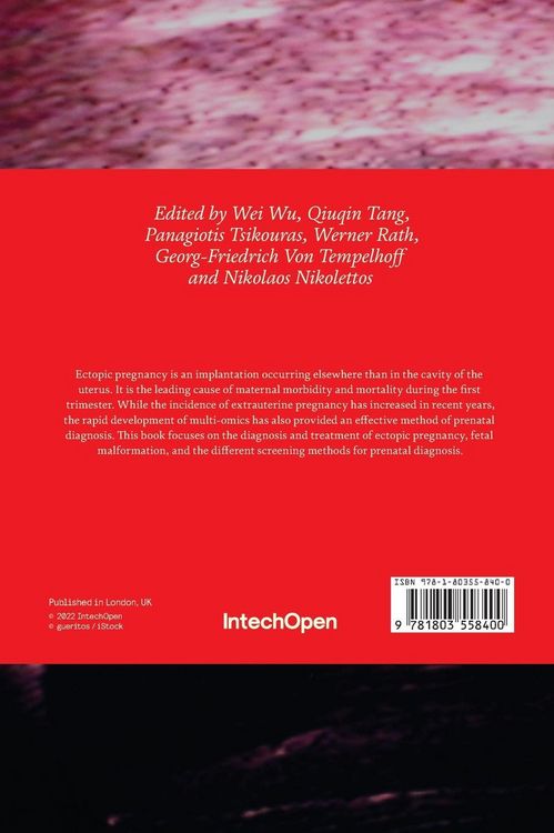 Produktbild: Ectopic Pregnancy and Prenatal Diagnosis