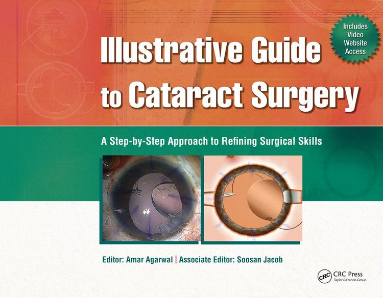 Produktbild: Illustrative Guide to Cataract Surgery