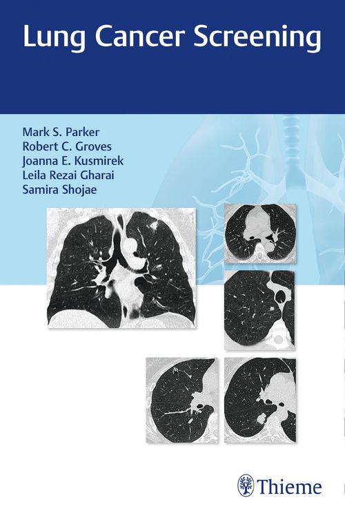 Produktbild: Lung Cancer Screening