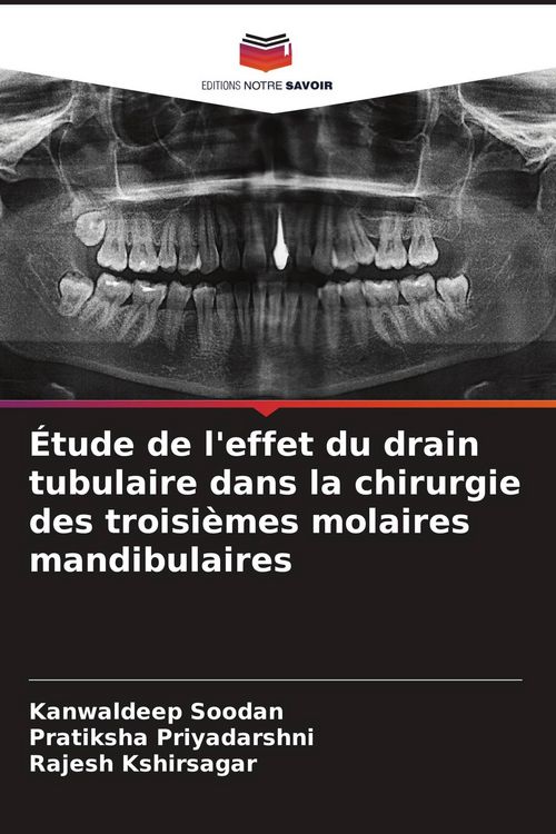 Produktbild: &Eacute;tude de l'effet du drain tubulaire dans la chirurgie des troisi&egrave;mes molaires mandibulaires