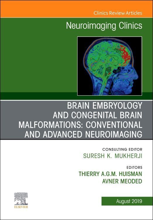 Produktbild: Brain Embryology and the Cause of Congenital Malformations, an Issue of Neuroimaging Clinics of North America