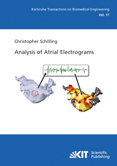 Produktbild: Analysis of Atrial Electrograms