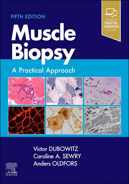 Produktbild: Muscle Biopsy E-Book