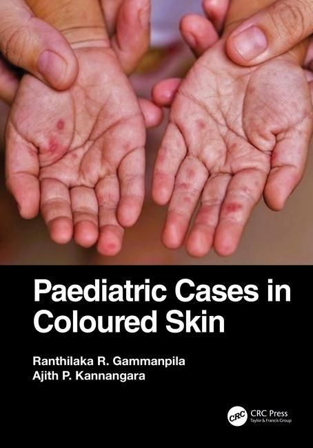 Produktbild: Kannangara, A: Paediatric Cases in Coloured Skin