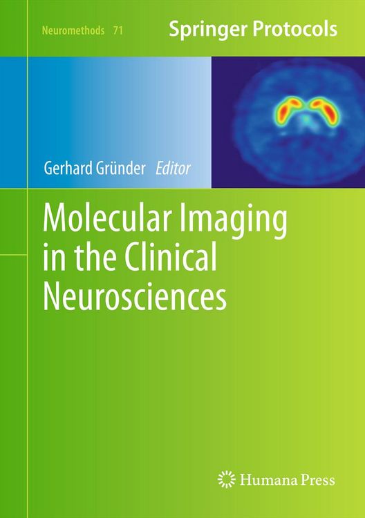 Produktbild: Molecular Imaging in the Clinical Neurosciences