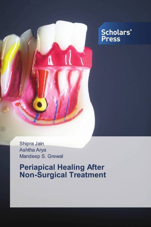 Produktbild: Periapical Healing After Non-Surgical Treatment