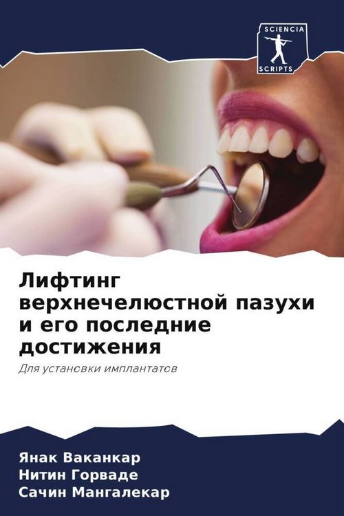 Produktbild: Lifting werhnechel&uuml;stnoj pazuhi i ego poslednie dostizheniq