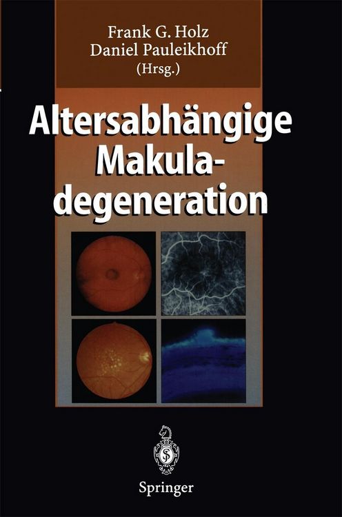 Produktbild: Altersabh&auml;ngige Makuladegeneration
