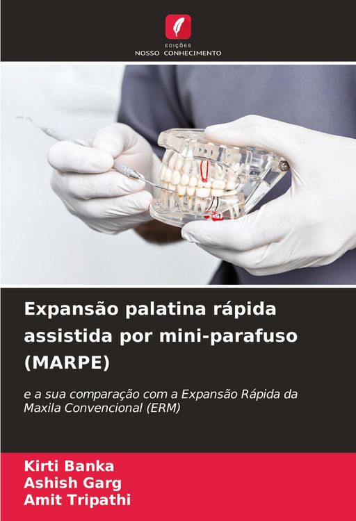 Produktbild: Expans&atilde;o palatina r&aacute;pida assistida por mini-parafuso (MARPE)