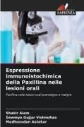 Produktbild: Espressione immunoistochimica della Paxillina nelle lesioni orali