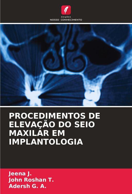 Produktbild: Procedimentos De Eleva&ccedil;&atilde;o Do Seio Maxilar Em Implantologia