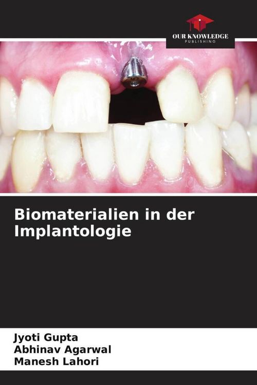 Produktbild: Biomaterialien in der Implantologie