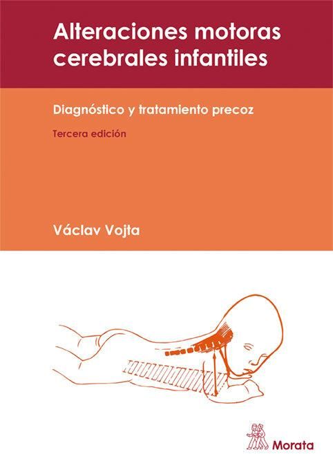 Produktbild: Alteraciones motoras cerebrales infantiles : diagn&oacute;stico y tratamiento precoz