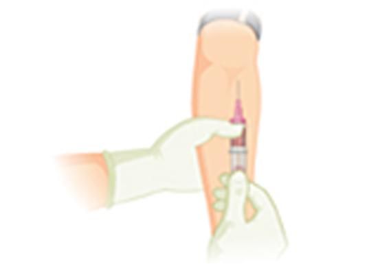 Produktbild: Estimation of Serum Creatinine and Calculation of Creatinine Clearance