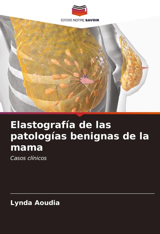 Produktbild: Elastograf&iacute;a de las patolog&iacute;as benignas de la mama