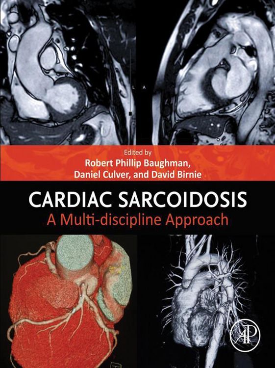 Produktbild: Cardiac Sarcoidosis