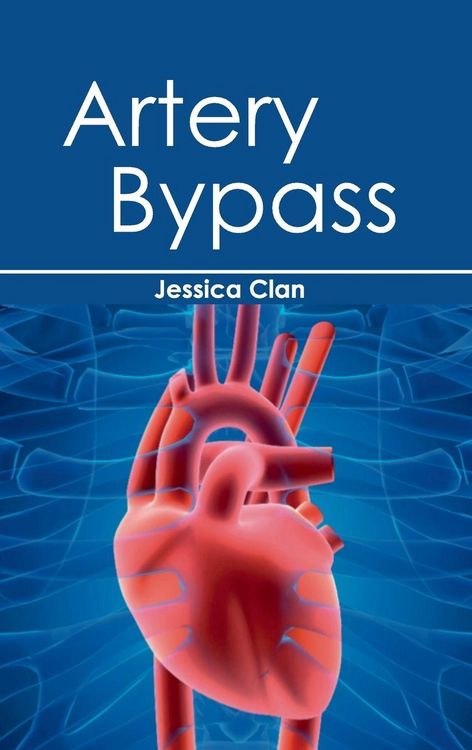 Produktbild: Artery Bypass