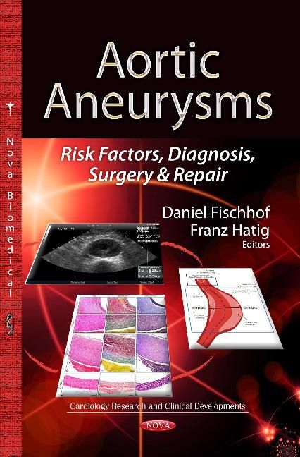 Produktbild: Aortic Aneurysms