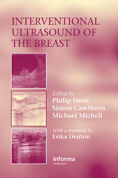Produktbild: Interventional Ultrasound of the Breast
