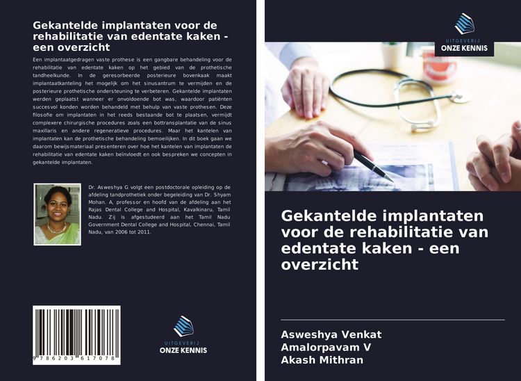 Produktbild: Gekantelde implantaten voor de rehabilitatie van edentate kaken - een overzicht