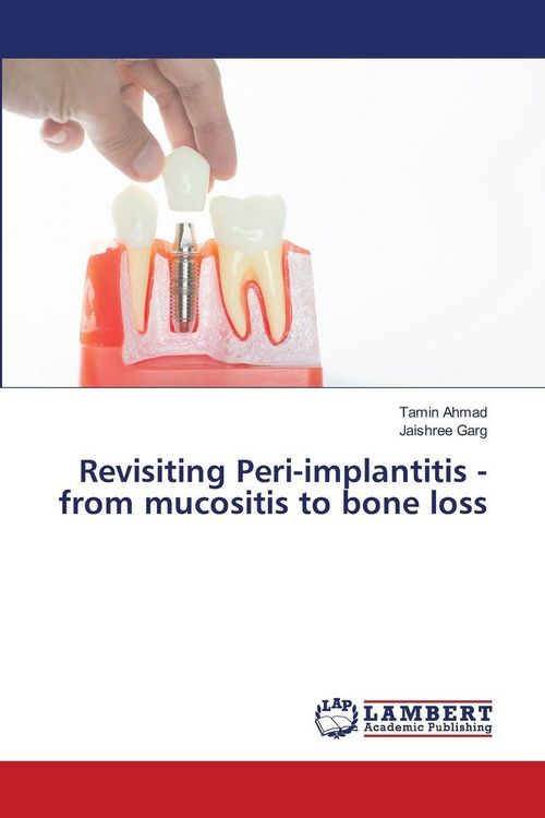 Produktbild: Revisiting Peri-implantitis - from mucositis to bone loss
