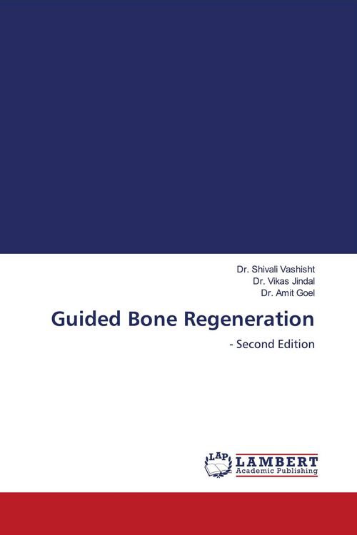 Produktbild: Guided Bone Regeneration