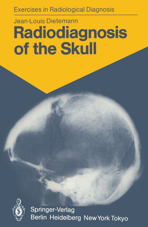 Produktbild: Radiodiagnosis of the Skull
