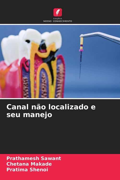 Produktbild: Canal n&atilde;o localizado e seu manejo