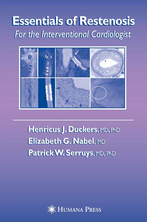 Produktbild: Essentials of Restenosis