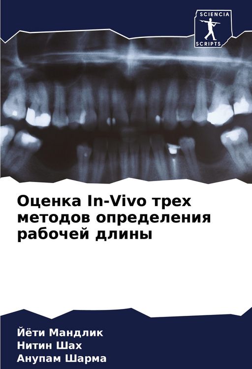 Produktbild: Ocenka In-Vivo treh metodow opredeleniq rabochej dliny