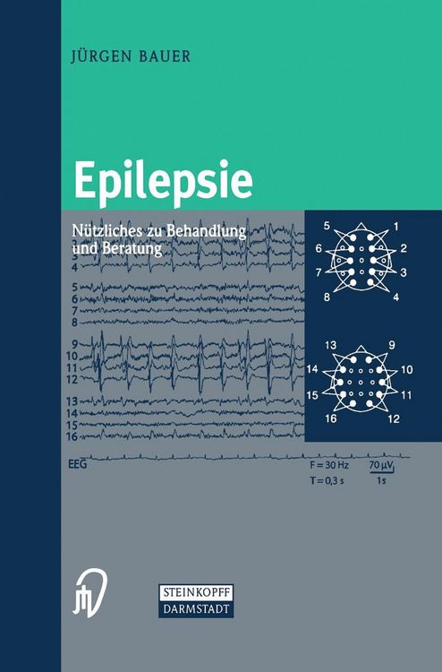 Produktbild: Epilepsie