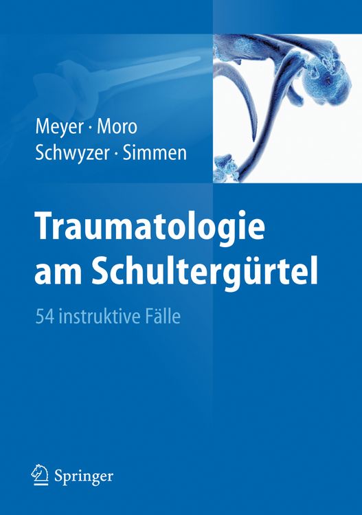 Produktbild: Traumatologie am Schulterg&uuml;rtel