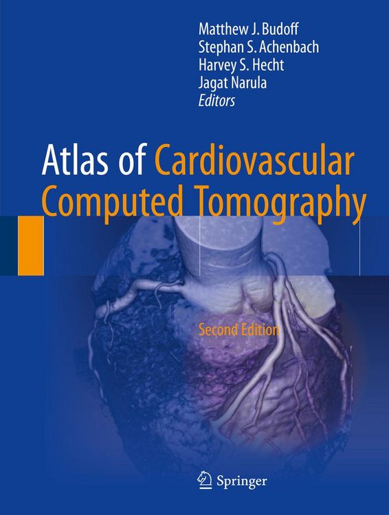 Produktbild: Atlas of Cardiovascular Computed Tomography