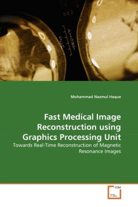 Produktbild: Haque, M: Fast Medical Image Reconstruction using Graphics P